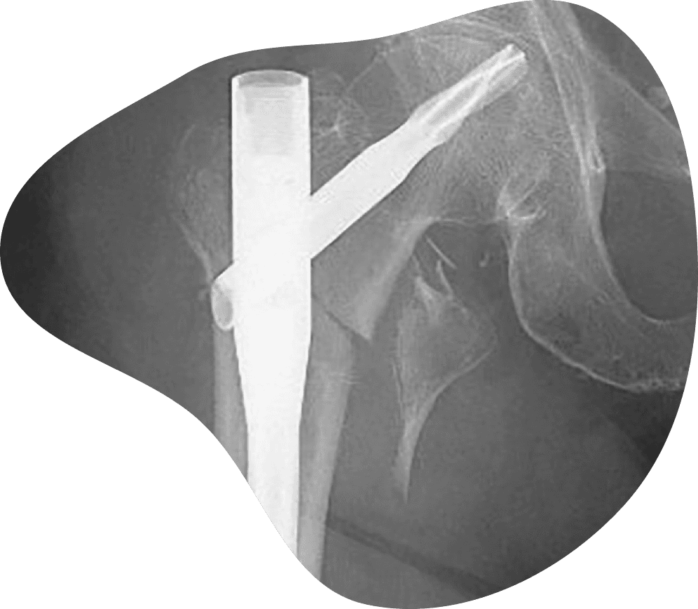 Guided rehabilitation after injury or surgery